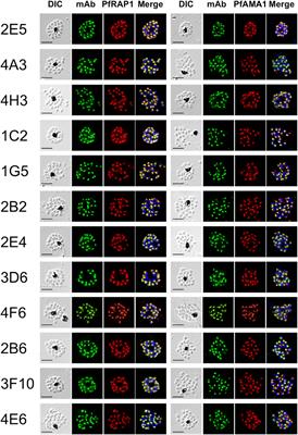 Identification of a Novel RAMA/RON3 Rhoptry Protein Complex in Plasmodium falciparum Merozoites